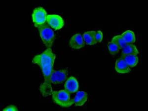 Immunocytochemistry/ Immunofluorescence - Anti-non-muscle Myosin IIA antibody [EPR8965] (AB138498)