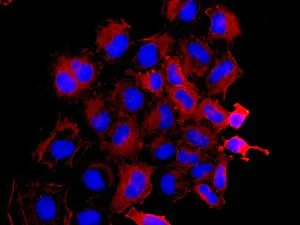 Immunocytochemistry/ Immunofluorescence - Anti-non-muscle Myosin IIA antibody [EPR8965] - BSA and Azide free (AB236073)