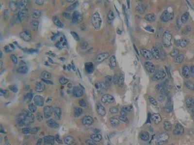 Immunohistochemistry (Formalin/PFA-fixed paraffin-embedded sections) - Anti-non-muscle Myosin IIB/MYH10 antibody (AB232975)