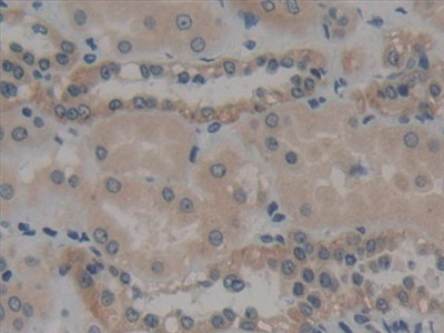 Immunohistochemistry (Formalin/PFA-fixed paraffin-embedded sections) - Anti-non-muscle Myosin IIB/MYH10 antibody (AB232975)