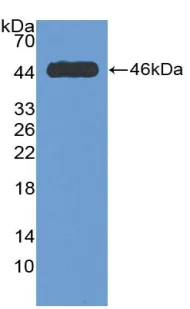 Western blot - Anti-non-muscle Myosin IIB/MYH10 antibody (AB232975)