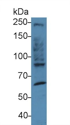 Western blot - Anti-non-muscle Myosin IIB/MYH10 antibody (AB232975)