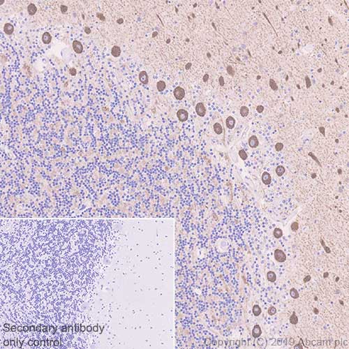 Immunohistochemistry (Formalin/PFA-fixed paraffin-embedded sections) - Anti-non-muscle Myosin IIB/MYH10 antibody [EPR22564-23] (AB230823), expandable thumbnail