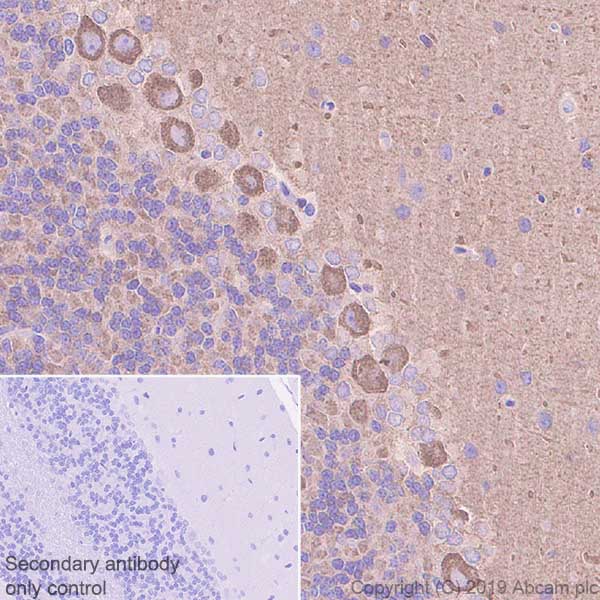 Immunohistochemistry (Formalin/PFA-fixed paraffin-embedded sections) - Anti-non-muscle Myosin IIB/MYH10 antibody [EPR22564-23] (ab230823), expandable thumbnail