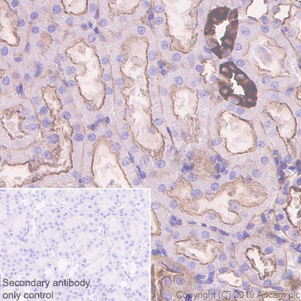 Immunohistochemistry (Formalin/PFA-fixed paraffin-embedded sections) - Anti-non-muscle Myosin IIB/MYH10 antibody [EPR22564-23] (ab230823), expandable thumbnail