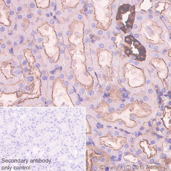 Immunohistochemistry (Formalin/PFA-fixed paraffin-embedded sections) - Anti-non-muscle Myosin IIB/MYH10 antibody [EPR22564-23] (AB230823)