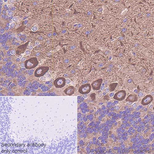 Immunohistochemistry (Formalin/PFA-fixed paraffin-embedded sections) - Anti-non-muscle Myosin IIB/MYH10 antibody [EPR22564-23] (ab230823), expandable thumbnail