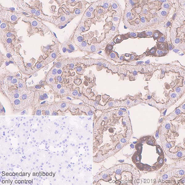 Immunohistochemistry (Formalin/PFA-fixed paraffin-embedded sections) - Anti-non-muscle Myosin IIB/MYH10 antibody [EPR22564-23] (ab230823), expandable thumbnail