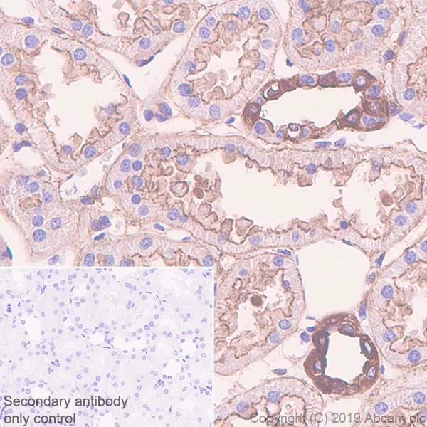 Immunohistochemistry (Formalin/PFA-fixed paraffin-embedded sections) - Anti-non-muscle Myosin IIB/MYH10 antibody [EPR22564-23] (AB230823)