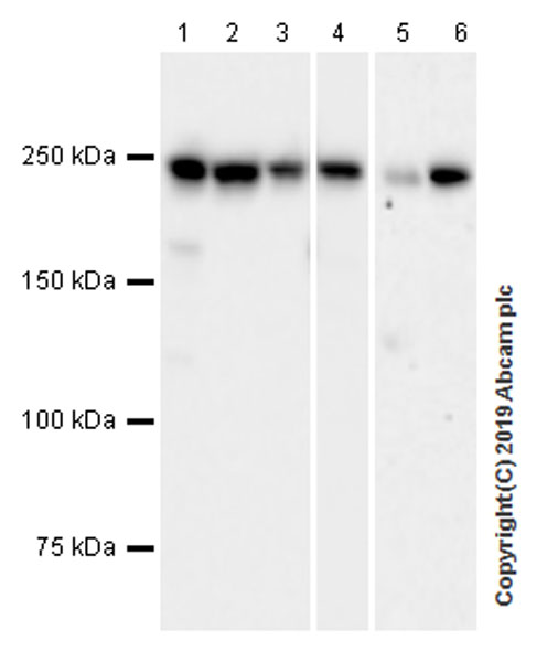 Western blot - Anti-non-muscle Myosin IIB/MYH10 antibody [EPR22564-23] (AB230823), expandable thumbnail