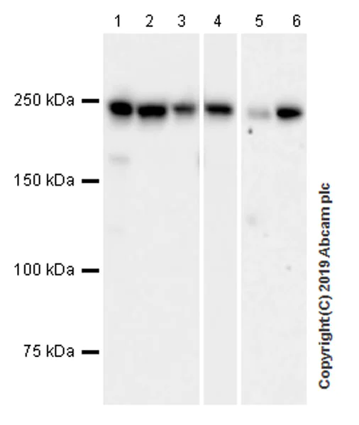 Western blot - Anti-non-muscle Myosin IIB/MYH10 antibody [EPR22564-23] (AB230823)