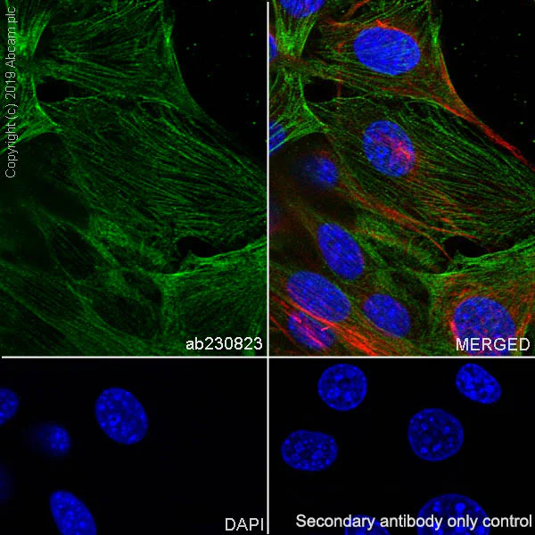 Immunocytochemistry/ Immunofluorescence - Anti-non-muscle Myosin IIB/MYH10 antibody [EPR22564-23] - BSA and Azide free (AB254472)