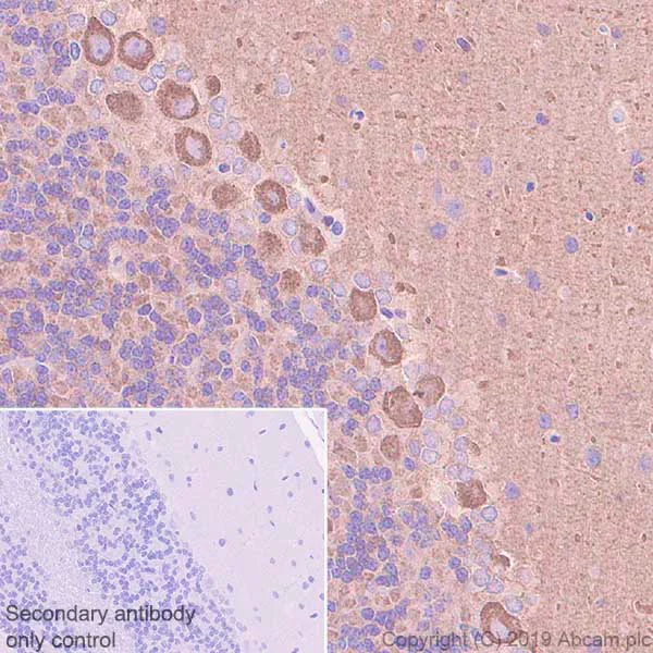 Immunohistochemistry (Formalin/PFA-fixed paraffin-embedded sections) - Anti-non-muscle Myosin IIB/MYH10 antibody [EPR22564-23] - BSA and Azide free (AB254472)