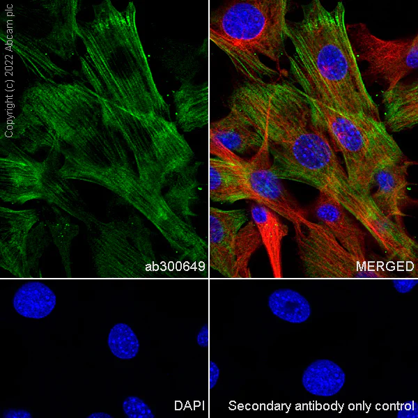 Immunocytochemistry/ Immunofluorescence - Anti-non-muscle Myosin IIB/MYH10 antibody [EPR22564-23] - Goat IgG (Chimeric) - BSA and Azide free (AB300649)