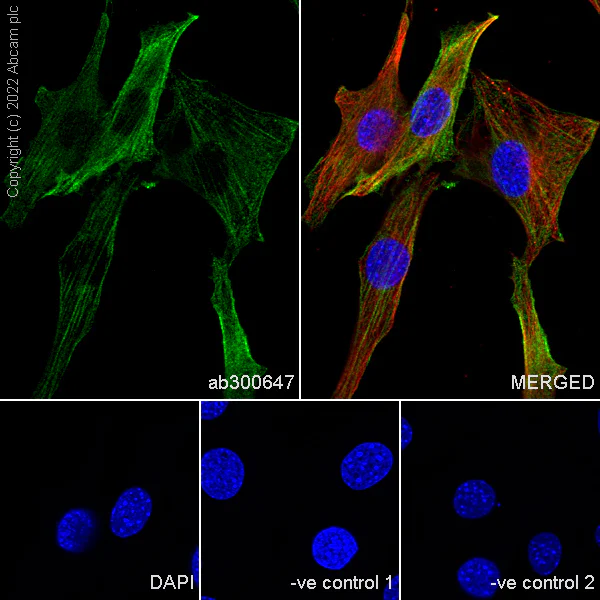 Immunocytochemistry/ Immunofluorescence - Anti-non-muscle Myosin IIB/MYH10 antibody [EPR22564-23] - Rat IgG2a (Chimeric) - BSA and Azide free (AB300648)