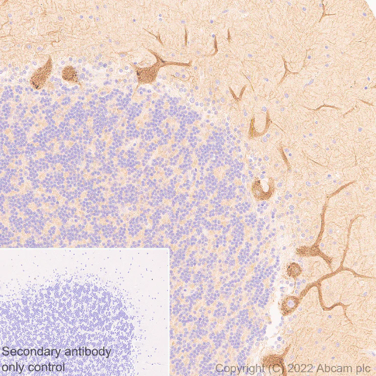 Immunohistochemistry (Formalin/PFA-fixed paraffin-embedded sections) - Anti-non-muscle Myosin IIB/MYH10 antibody [EPR22564-23] - Rat IgG2a (Chimeric) - BSA and Azide free (AB300648)