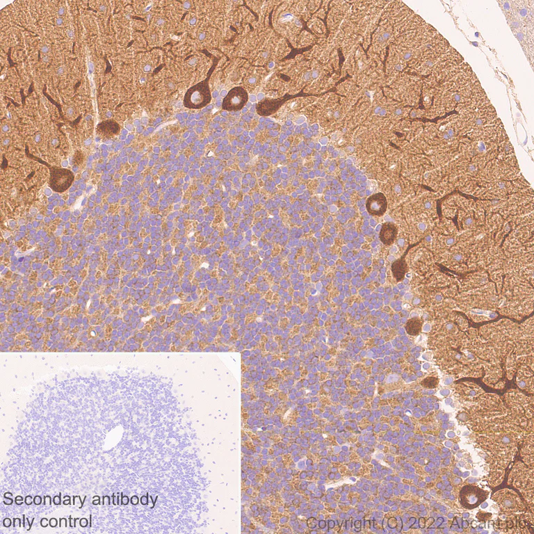 Immunohistochemistry (Formalin/PFA-fixed paraffin-embedded sections) - Anti-non-muscle Myosin IIB/MYH10 antibody [EPR22564-23] - Rat IgG2a (Chimeric) - BSA and Azide free (AB300648)