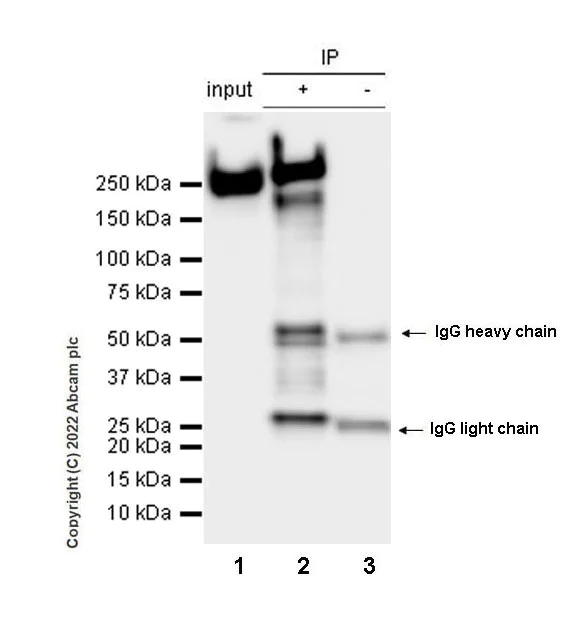 Immunoprecipitation - Anti-non-muscle Myosin IIB/MYH10 antibody [EPR22564-23] - Rat IgG2a (Chimeric) - BSA and Azide free (AB300648)
