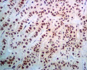 Immunohistochemistry (Formalin/PFA-fixed paraffin-embedded sections) - Anti-NOP10 antibody [EPR8856] (AB133726)