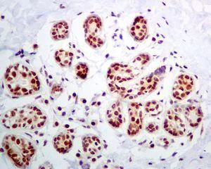 Immunohistochemistry (Formalin/PFA-fixed paraffin-embedded sections) - Anti-NOP10 antibody [EPR8856] - BSA and Azide free (AB248630)