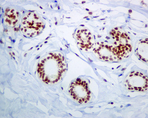 Immunohistochemistry (Formalin/PFA-fixed paraffin-embedded sections) - Anti-NOP10 antibody [EPR8857] (AB134902)