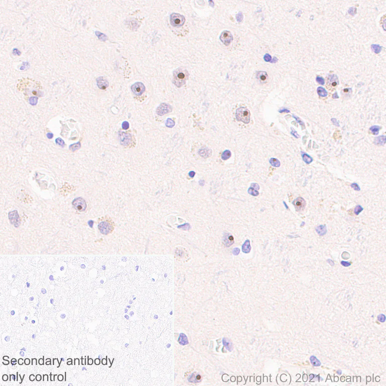 Immunohistochemistry (Formalin/PFA-fixed paraffin-embedded sections) - Anti-NOP2 antibody [EPR24888-92] - BSA and Azide free (AB282822)
