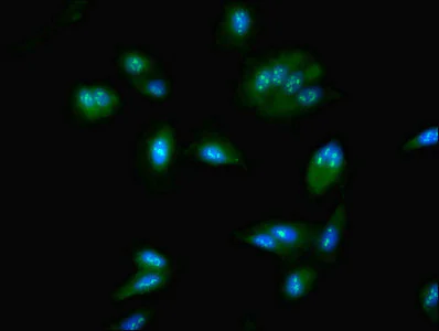 Immunocytochemistry/ Immunofluorescence - Anti-NOP58 antibody (AB236724)