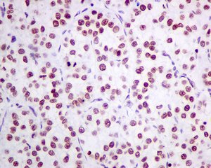 Immunohistochemistry (Formalin/PFA-fixed paraffin-embedded sections) - Anti-NOP58 antibody [EPR10721] - BSA and Azide free (AB249222), expandable thumbnail