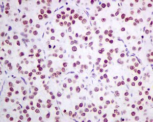 Immunohistochemistry (Formalin/PFA-fixed paraffin-embedded sections) - Anti-NOP58 antibody [EPR10721] - BSA and Azide free (AB249222)