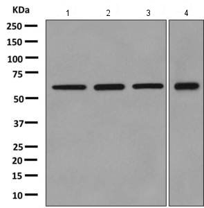 Western blot - Anti-NOP58 antibody [EPR10721] - BSA and Azide free (AB249222), expandable thumbnail