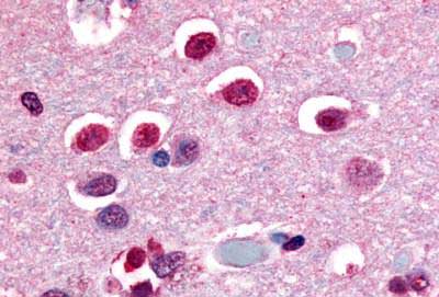 Immunohistochemistry (Formalin/PFA-fixed paraffin-embedded sections) - Anti-NOR1/TEC antibody - C-terminal (AB188752), expandable thumbnail