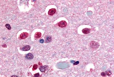 Immunohistochemistry (Formalin/PFA-fixed paraffin-embedded sections) - Anti-NOR1/TEC antibody - C-terminal (AB188752)