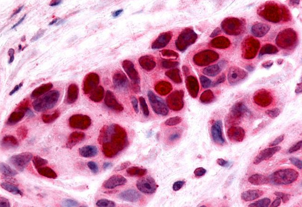 Immunohistochemistry (Formalin/PFA-fixed paraffin-embedded sections) - Anti-NOR1/TEC antibody - C-terminal (AB188752), expandable thumbnail