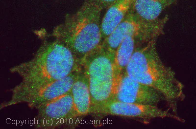 Immunocytochemistry/ Immunofluorescence - Anti-Noradrenaline transporter antibody (AB41559)