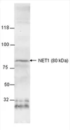 Western blot - Anti-Noradrenaline transporter antibody (AB41559)