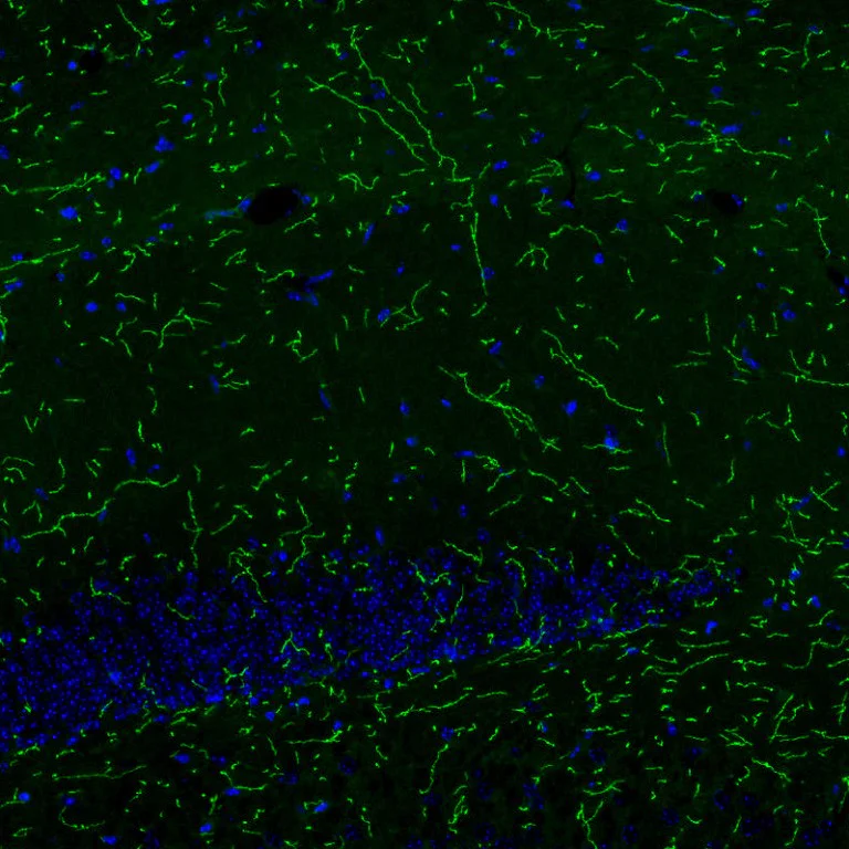 Immunohistochemistry (Formalin/PFA-fixed paraffin-embedded sections) - Anti-Noradrenaline transporter antibody [CL3063] (AB211463)