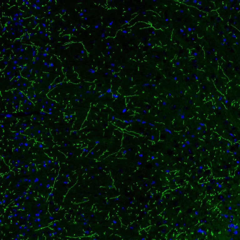 Immunohistochemistry (Formalin/PFA-fixed paraffin-embedded sections) - Anti-Noradrenaline transporter antibody [CL3063] (AB211463)