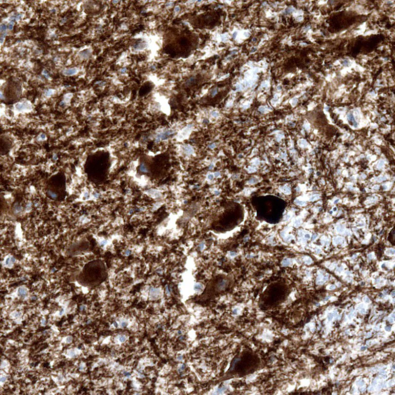 Immunohistochemistry (Formalin/PFA-fixed paraffin-embedded sections) - Anti-Noradrenaline transporter antibody [CL3063] (AB211463)