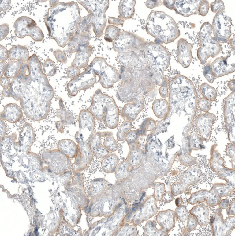 Immunohistochemistry (Formalin/PFA-fixed paraffin-embedded sections) - Anti-Noradrenaline transporter antibody [CL3063] (AB211463)