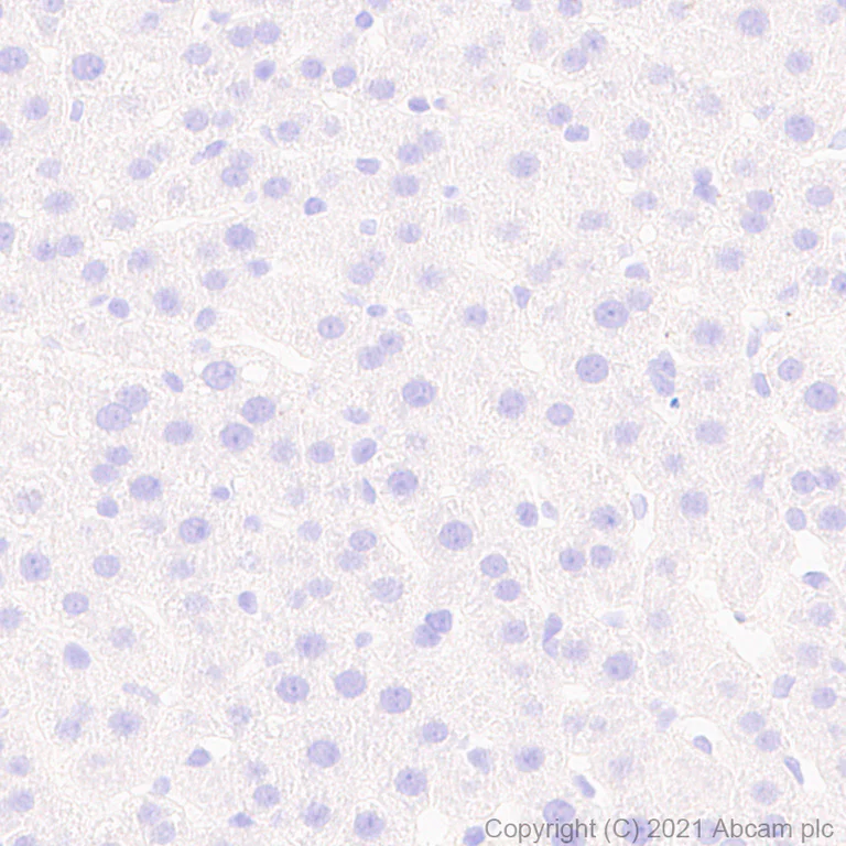 Immunohistochemistry (Formalin/PFA-fixed paraffin-embedded sections) - Anti-Noradrenaline transporter antibody [EPR23527-534] (AB254361)