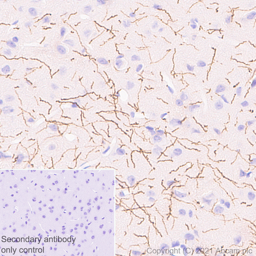 Immunohistochemistry (Formalin/PFA-fixed paraffin-embedded sections) - Anti-Noradrenaline transporter antibody [EPR23527-534] (AB254361), expandable thumbnail