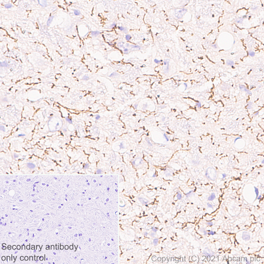 Immunohistochemistry (Formalin/PFA-fixed paraffin-embedded sections) - Anti-Noradrenaline transporter antibody [EPR23527-534] (AB254361), expandable thumbnail