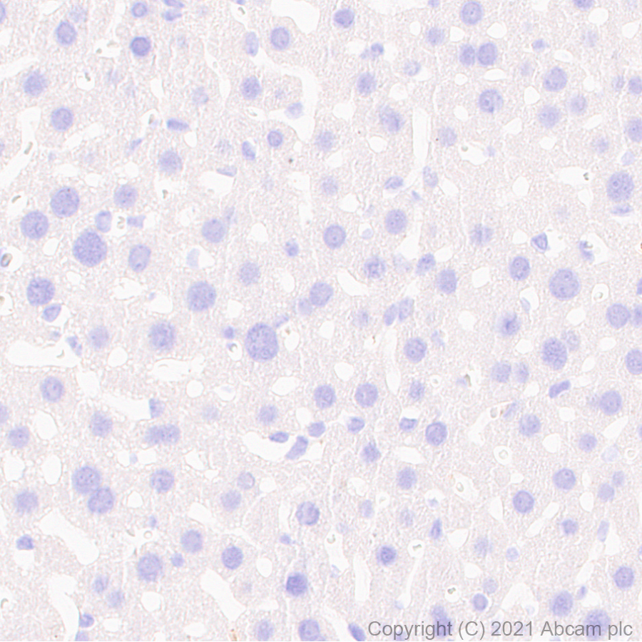 Immunohistochemistry (Formalin/PFA-fixed paraffin-embedded sections) - Anti-Noradrenaline transporter antibody [EPR23527-534] (ab254361), expandable thumbnail
