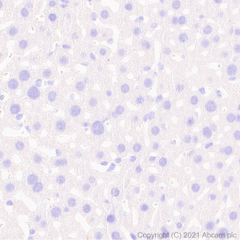 Immunohistochemistry (Formalin/PFA-fixed paraffin-embedded sections) - Anti-Noradrenaline transporter antibody [EPR23527-534] (AB254361)