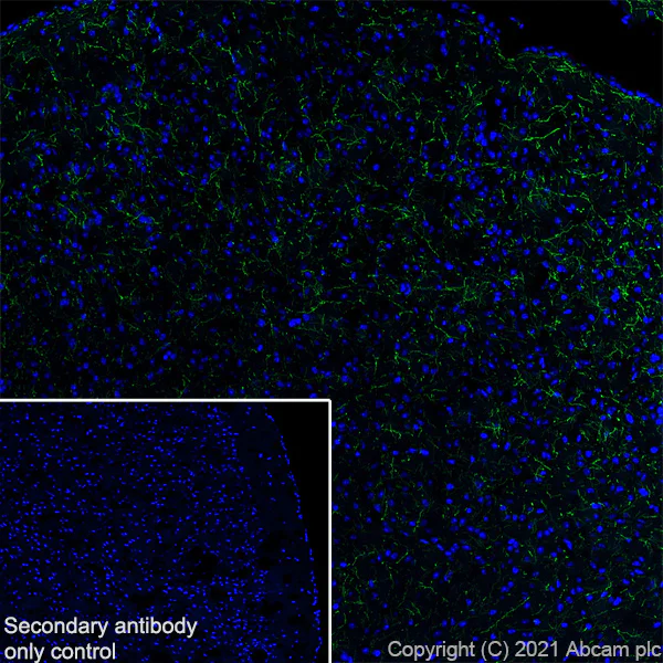 Immunohistochemistry (Frozen sections) - Anti-Noradrenaline transporter antibody [EPR23527-534] (AB254361)