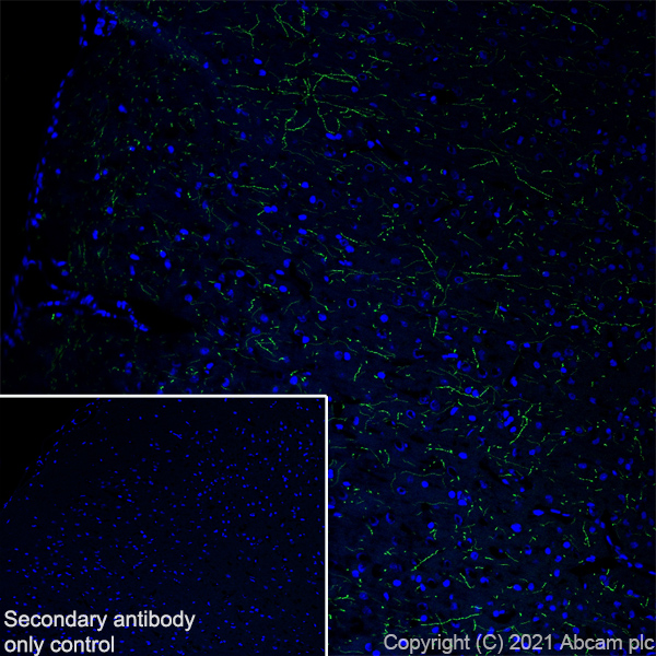 Immunohistochemistry (Frozen sections) - Anti-Noradrenaline transporter antibody [EPR23527-534] (AB254361), expandable thumbnail