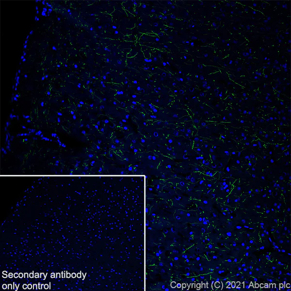Immunohistochemistry (Frozen sections) - Anti-Noradrenaline transporter antibody [EPR23527-534] (AB254361)