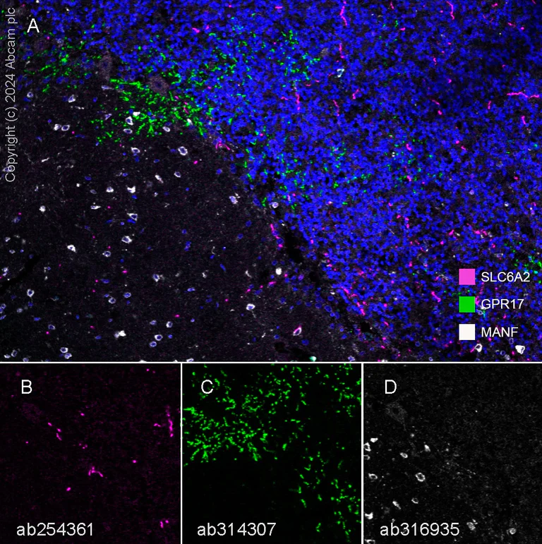 Multiplex immunohistochemistry - Anti-Noradrenaline transporter antibody [EPR23527-534] (AB254361)