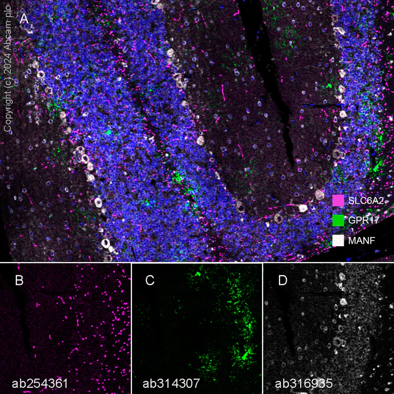 Multiplex immunohistochemistry - Anti-Noradrenaline transporter antibody [EPR23527-534] (AB254361)