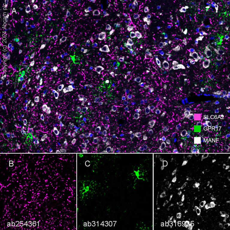Multiplex immunohistochemistry - Anti-Noradrenaline transporter antibody [EPR23527-534] (AB254361)